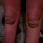 Knees look like trapped baby Kuato 3