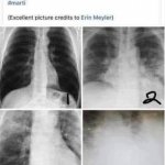 X-Rays - Normal, Flu, Pneumonia, COVID meme