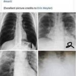 NEW TEMPLATE: compares COVID X-RAYS to Normal, Flu, Pneumonia (SEE COMMENTS) | image tagged in x-rays - normal flu pneumonia covid,covid,covid-19,coronavirus,pneumonia,rick75230 | made w/ Imgflip meme maker