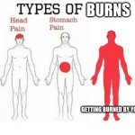 Burned by crush | BURNS; GETTING BURNED BY YOUR CRUSH | image tagged in types of pain,memes,burned,crush,ouch,rekt | made w/ Imgflip meme maker