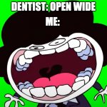 Pelo, Peludo, Pelito, Peligro | ME:; DENTIST: OPEN WIDE | image tagged in pelones,sr pelo | made w/ Imgflip meme maker