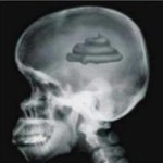 X-rays poop brain #1