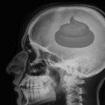 X-rays poop brains #2