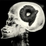 X-rays poop brains #4