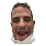 Hunter Biden meth teeth #1