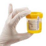 Urine sample