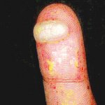 deep fried sus blister meme