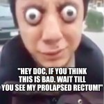Doctors have a tough job... | WORDS FEW DOCTORS EVER WANT TO HEAR... "HEY DOC, IF YOU THINK THIS IS BAD. WAIT TILL YOU SEE MY PROLAPSED RECTUM!" | image tagged in eyeballs out boy,illness,doctor,jobs | made w/ Imgflip meme maker
