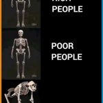 Abnormal human skeleton