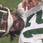 Aaron Rodgers late hit face