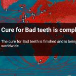 Cure  bad teeth