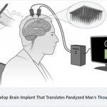 Brain Implant Reads Thoughts