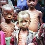 Starving kids