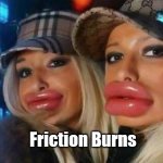 Friction | A B; Friction Burns | image tagged in memes,duck face chicks,friction burns,bjs,kamala harris,big lips | made w/ Imgflip meme maker