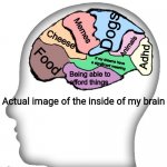 My brain all at once | Dogs; Memes; Cheese; Animals; Adhd; Food; If my dreams have a significant meaning; Being able to afford things | image tagged in actual image of the inside of my brain | made w/ Imgflip meme maker