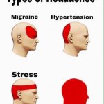 types of headaches