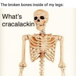 Soccer | The soccer player competing against me: accidentally kicks my leg so hard while kicking the soccer ball away from me and scores a goal; The broken bones inside of my legs: | image tagged in what's cracalackin,funny,memes,blank white template,soccer,ball | made w/ Imgflip meme maker