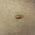 Sezmos third nipple
