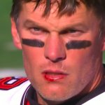 Tom Brady - Bloody Lip