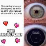 "Eye" love you! Heh get it? | 💖; ❤️; YOUR PRECIOUS SMILE; 💖; 💗 | image tagged in expanding eye,wholesome | made w/ Imgflip meme maker