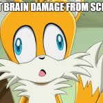 brain damage | I GOT BRAIN DAMAGE FROM SCHOOL | image tagged in sonic- derp tails | made w/ Imgflip meme maker
