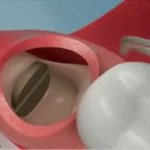 teeth removal GIF Template