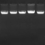 genomic dna gel electrophoresis