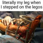 ouch | literally my leg when I stepped on the legos | image tagged in broken leg,memes,lego,don't try this at home,trust me | made w/ Imgflip meme maker