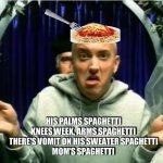 Mom's Spaghetti | HIS PALMS SPAGHETTI
KNEES WEEK, ARMS SPAGHETTI
THERE'S VOMIT ON HIS SWEATER SPAGHETTI
MOM'S SPAGHETTI | image tagged in eminem | made w/ Imgflip meme maker