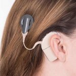 Nice cochlear implant