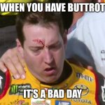 Kyle Busch Bleeding | WHEN YOU HAVE BUTTROT; IT'S A BAD DAY | image tagged in kyle busch bleeding | made w/ Imgflip meme maker