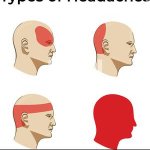 Types of Headaches template