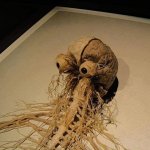 Nervous system