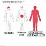Where does it hurt | YOUR VIDEO WILL BEGIN AFTER THIS AD | image tagged in where does it hurt | made w/ Imgflip meme maker