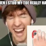 Toe stub | WHEN I STUB MY TOE REALLY HARD | image tagged in low quality albert screaming | made w/ Imgflip meme maker