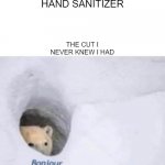 it really burns. | ME: USES HAND SANITIZER; THE CUT I NEVER KNEW I HAD | image tagged in bonjour | made w/ Imgflip meme maker