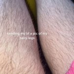 Hirsute Hairy legs woman