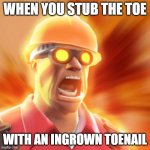 It is true tho | WHEN YOU STUB THE TOE; WITH AN INGROWN TOENAIL | image tagged in tf2 engineer,tf2,funny,truth,relatable,gaming | made w/ Imgflip meme maker