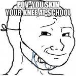 We gotta hold em in | POV: YOU SKIN YOUR KNEE AT SCHOOL | image tagged in cry behind mask,memes,meme,funny memes,funny meme,funny | made w/ Imgflip meme maker
