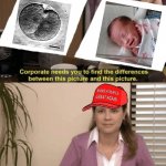 Pro-life logic meme