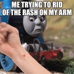 And it just had to be on the wrist | ME TRYING TO RID OF THE RASH ON MY ARM | image tagged in thomas had never seen such bullshit before clean version | made w/ Imgflip meme maker