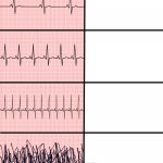 heart rhythms | OTHERS HEART BEATS; MINE | image tagged in heart rhythms | made w/ Imgflip meme maker