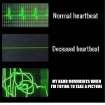 My hands are more unstable than uranium | MY HAND MOVEMENTS WHEN I'M TRYING TO TAKE A PICTURE | image tagged in normal heartbeat deceased heartbeat,memes,funny,heartbeat | made w/ Imgflip meme maker