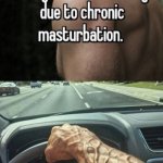 Veiny arms are usually due to chronic masturbation