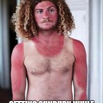 Sunburn | FLORIDA PROBLEMS:; GETTING SUNBURN WHILE DECORATING FOR HALLOWEEN | image tagged in sunburn | made w/ Imgflip meme maker