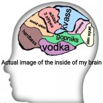 Actual image of the inside of my brain | kvass; adidas 3 stripes; soviet union; semechki; slav squat; hardbass; gopniks; vodka | image tagged in actual image of the inside of my brain | made w/ Imgflip meme maker