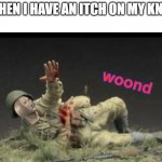 Meme Man Woond | WHEN I HAVE AN ITCH ON MY KNEE | image tagged in meme man woond | made w/ Imgflip meme maker