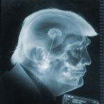 Trump small brain  Treason Idiot Republican Nazi Traitor