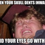 :) | WHEN YOUR SKULL DENTS INWARDS; AND YOUR EYES GO WITH IT | image tagged in memes,wtf | made w/ Imgflip meme maker