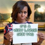 Michelle Obama Sign | IT'S A VERY LARGE SKIN TAG | image tagged in michelle obama sign | made w/ Imgflip meme maker